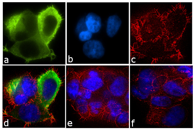 CRHR1 Antibody in Immunocytochemistry (ICC/IF)