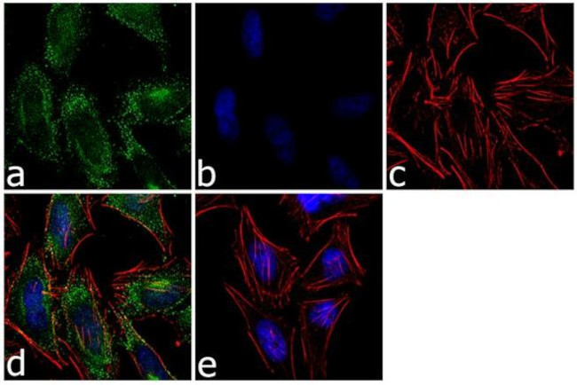 AS160 Antibody in Immunocytochemistry (ICC/IF)