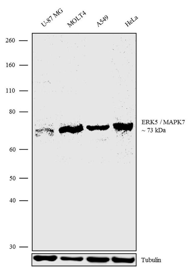 ERK5 Antibody in Western Blot (WB)