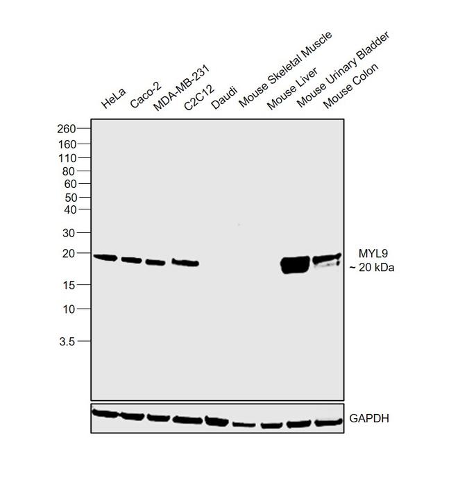 MYL9 Antibody in Western Blot (WB)