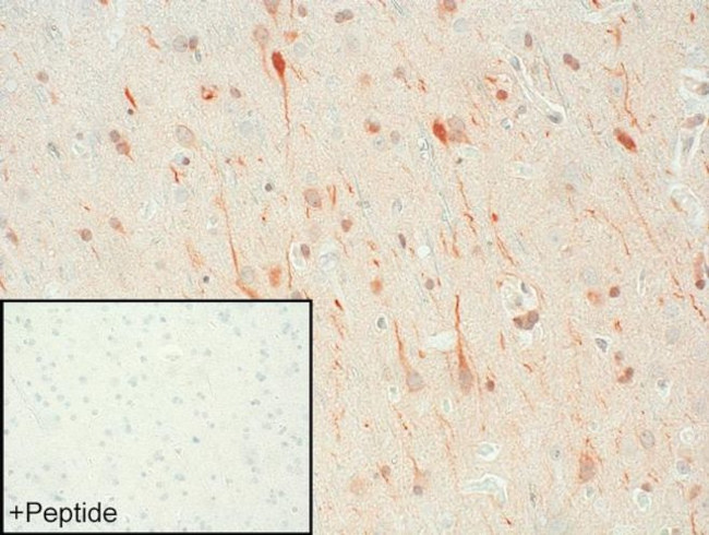 DRD1 Antibody in Immunohistochemistry (IHC)