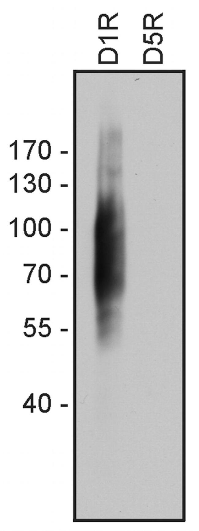 DRD1 Antibody in Western Blot (WB)