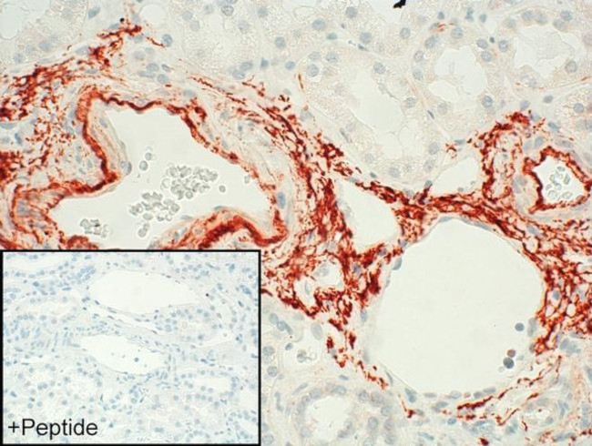 FPR2 Antibody in Immunohistochemistry (IHC)