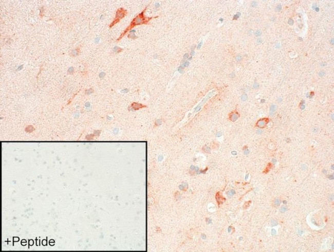 FPR2 Antibody in Immunohistochemistry (IHC)