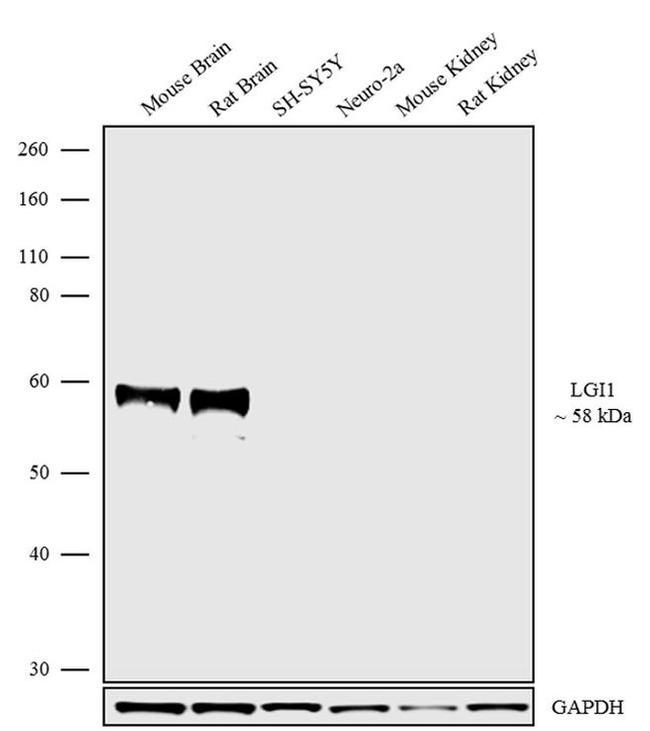 LGI1 Antibody in Western Blot (WB)