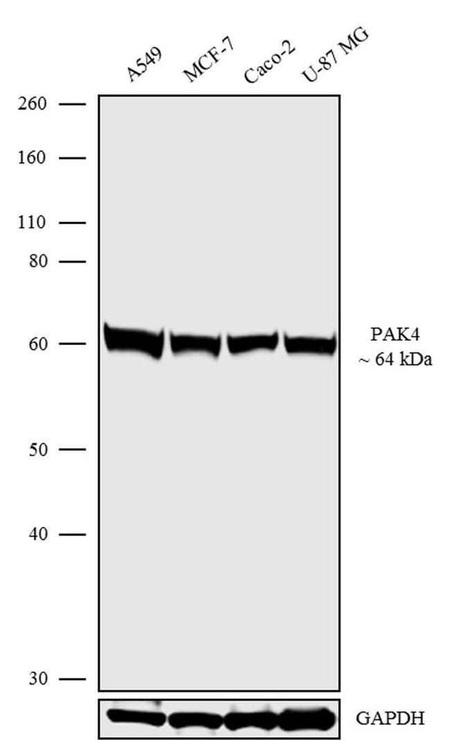 PAK4 Antibody in Western Blot (WB)