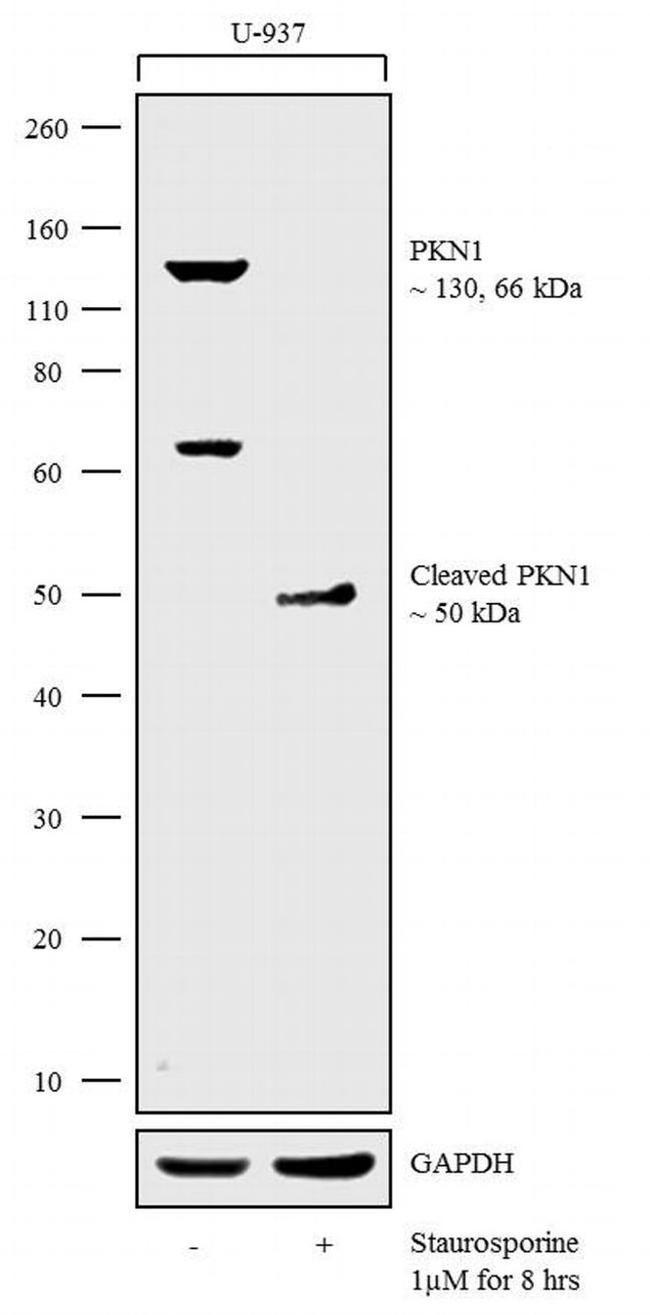 PKN1 Antibody in Western Blot (WB)