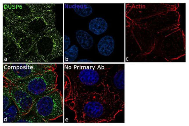 MKP3 Antibody in Immunocytochemistry (ICC/IF)