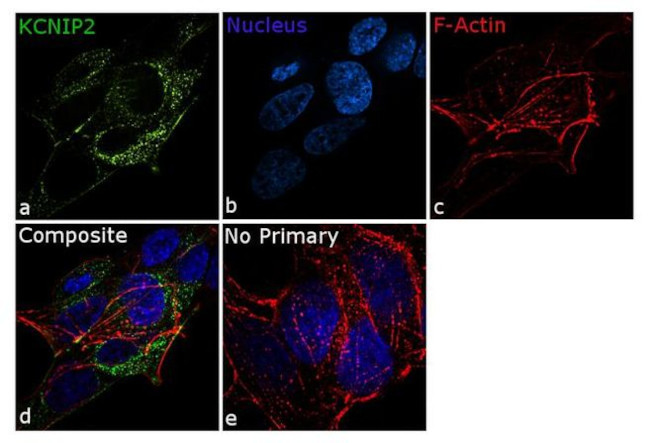 KChIP2 Antibody in Immunocytochemistry (ICC/IF)