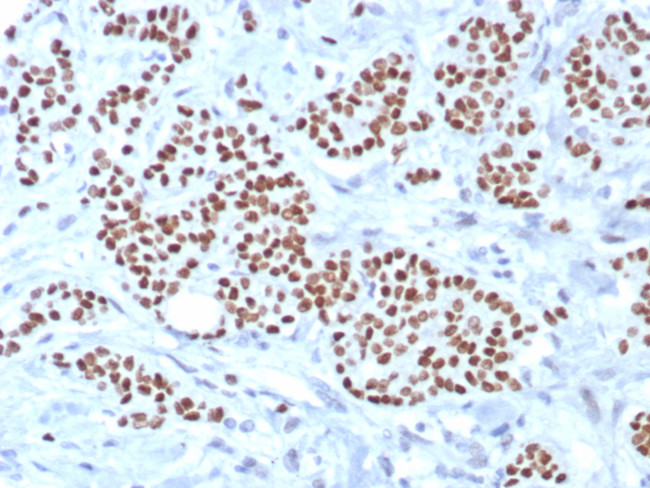 TRPS1 (Transcriptional repressor GATA binding 1) Antibody in Immunohistochemistry (Paraffin) (IHC (P))