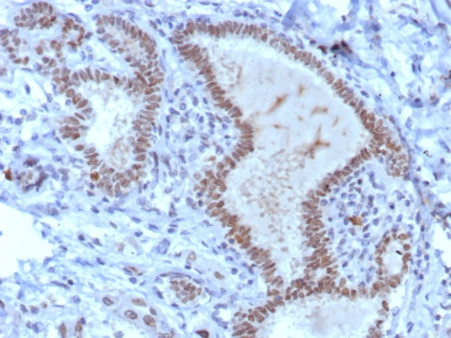 TRPS1 (Transcriptional repressor GATA binding 1) Antibody in Immunohistochemistry (Paraffin) (IHC (P))