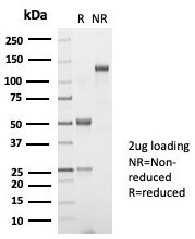 Thyroid Stimulating Hormone, beta (TSH beta) (Pituitary Marker) Antibody in SDS-PAGE (SDS-PAGE)