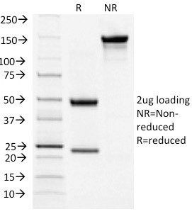 TSH-Receptor, B-Chain (Thyroid Marker) Antibody in SDS-PAGE (SDS-PAGE)