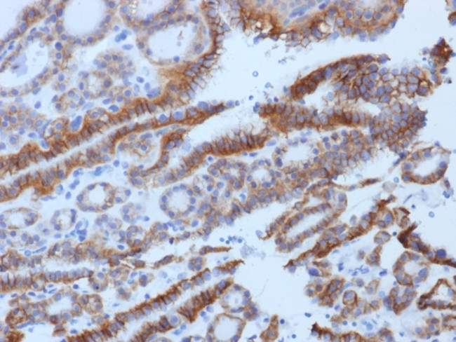 TSH-Receptor, B-Chain (Thyroid Marker) Antibody in Immunohistochemistry (Paraffin) (IHC (P))