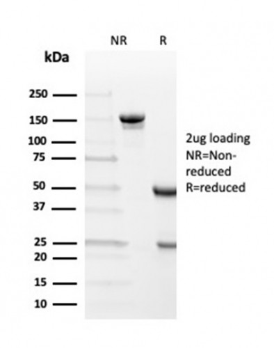 Transthyretin (Prealbumin) Antibody in SDS-PAGE (SDS-PAGE)