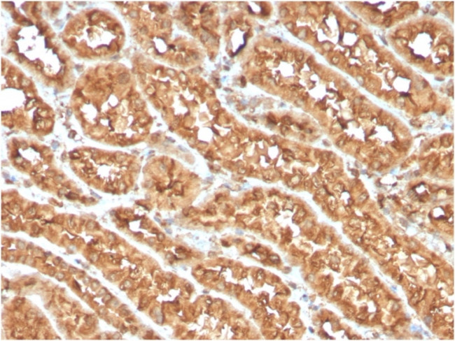 OX40/CD134/ TNFRSF4 (Immuno-Oncology Target) Antibody in Immunohistochemistry (Paraffin) (IHC (P))