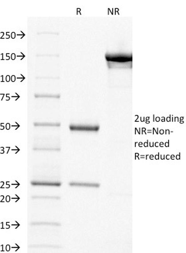 Thymidylate Synthase Antibody in SDS-PAGE (SDS-PAGE)