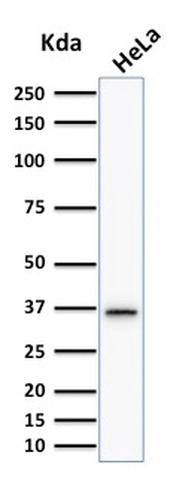 Thymidylate Synthase Antibody in Western Blot (WB)