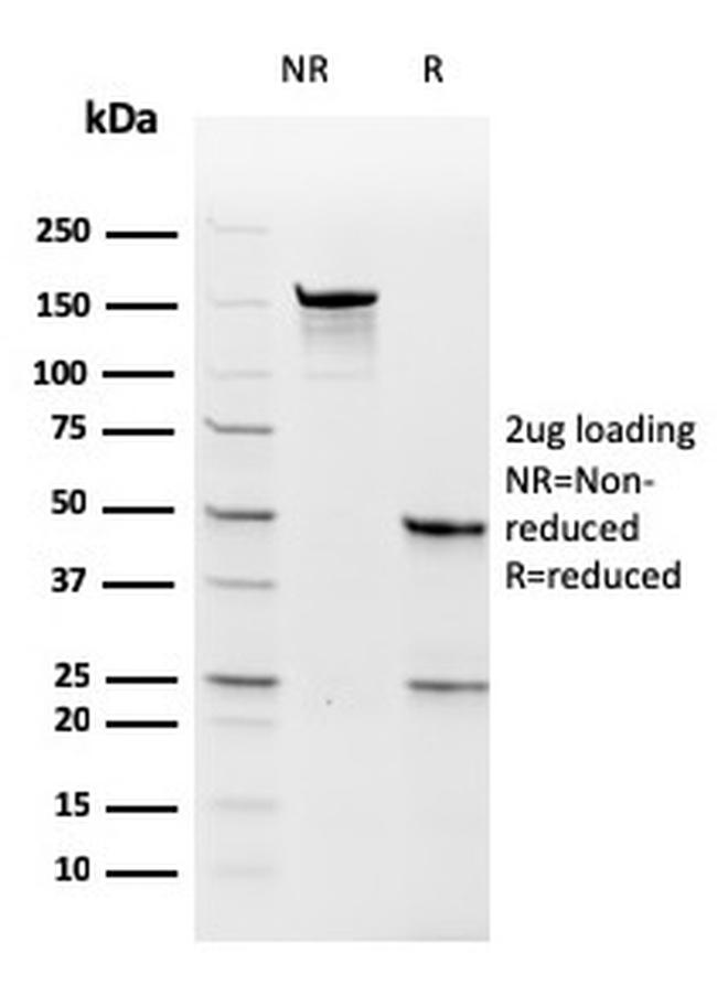 Thymidylate Synthase Antibody in SDS-PAGE (SDS-PAGE)