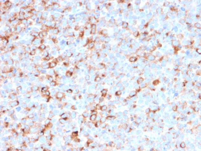 Tyrosinase (Melanoma Marker) Antibody in Immunohistochemistry (Paraffin) (IHC (P))