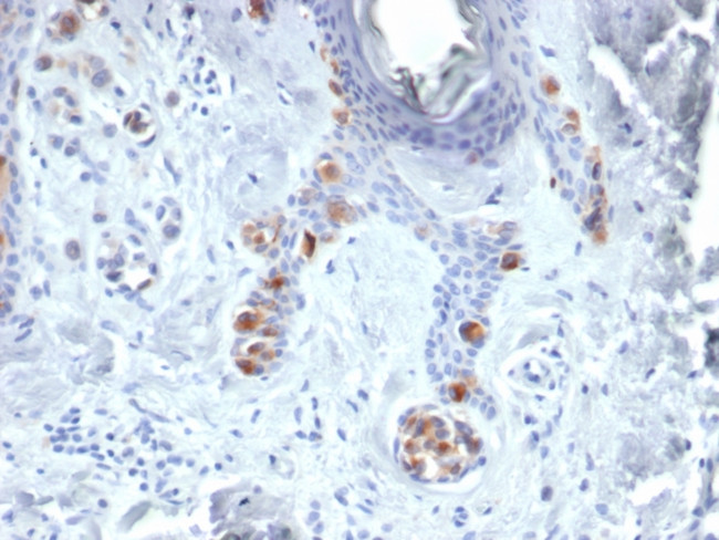 Tyrosinase Antibody in Immunohistochemistry (Paraffin) (IHC (P))