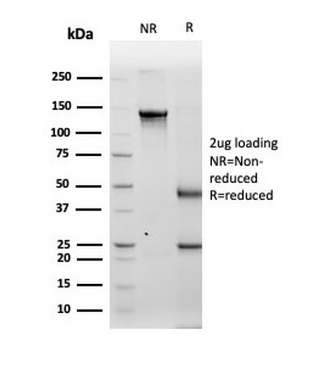 Tyrosinase Antibody in SDS-PAGE (SDS-PAGE)