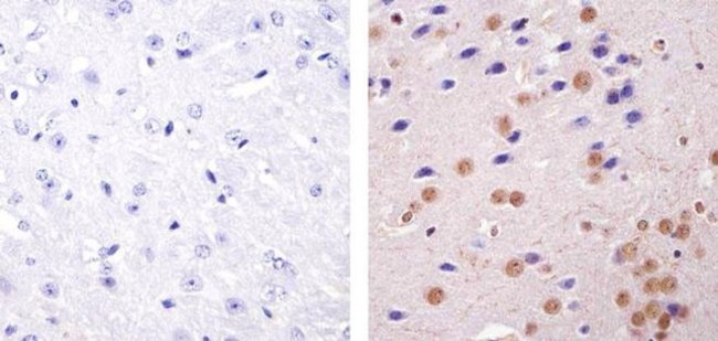 HP1 alpha Antibody in Immunohistochemistry (Paraffin) (IHC (P))