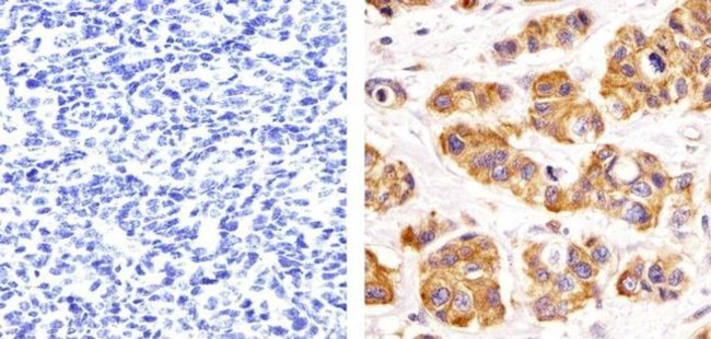 PRMT3 Antibody in Immunohistochemistry (Paraffin) (IHC (P))