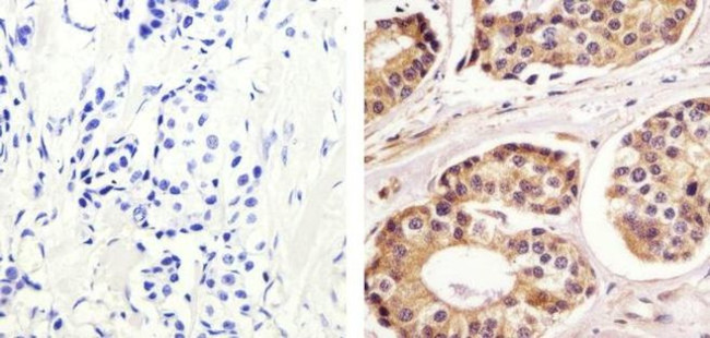 PRMT5 Antibody in Immunohistochemistry (Paraffin) (IHC (P))