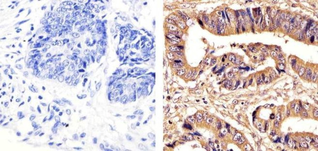 PRMT5 Antibody in Immunohistochemistry (Paraffin) (IHC (P))