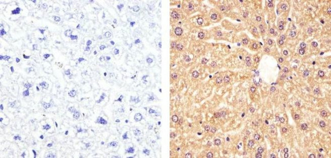 PRMT5 Antibody in Immunohistochemistry (Paraffin) (IHC (P))