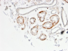 GTF2H2C (Transcription Factor) Antibody in Immunohistochemistry (Paraffin) (IHC (P))