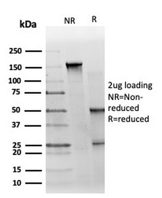 GTF2H2C (Transcription Factor) Antibody in SDS-PAGE (SDS-PAGE)