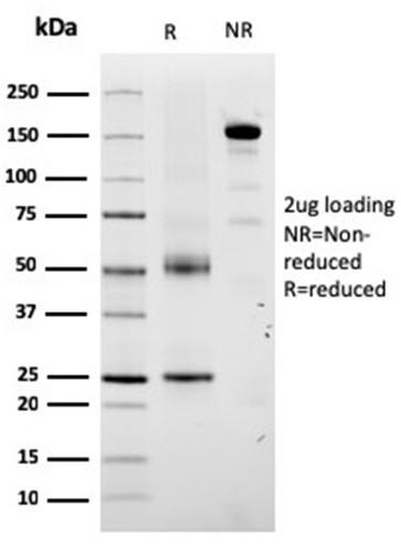 Tyrosinase-Related Protein-1 (TYRP-1) (Melanoma Marker) Antibody in SDS-PAGE (SDS-PAGE)