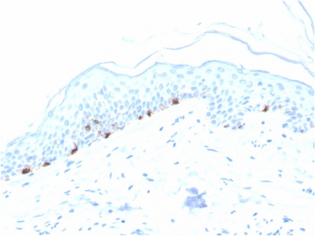 Tyrosinase-Related Protein-1 (TYRP-1) (Melanoma Marker) Antibody in Immunohistochemistry (Paraffin) (IHC (P))