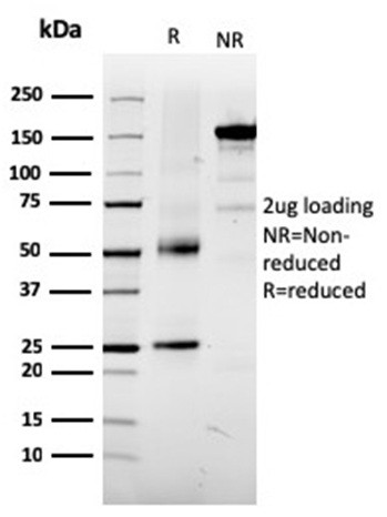 Tyrosinase-Related Protein-1 (TYRP-1) (Melanoma Marker) Antibody in SDS-PAGE (SDS-PAGE)