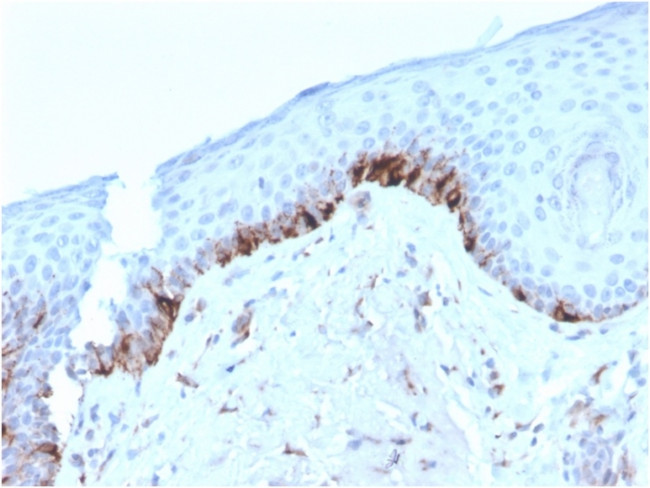 Tyrosinase-Related Protein-1 (TYRP-1) Antibody in Immunohistochemistry (Paraffin) (IHC (P))