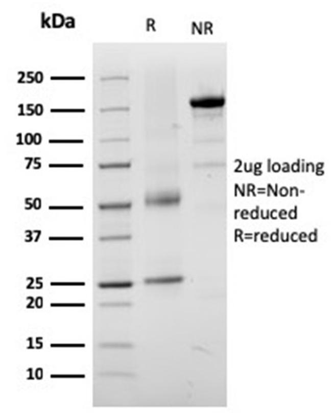 Tyrosinase-Related Protein-1 (TYRP-1) Antibody in SDS-PAGE (SDS-PAGE)