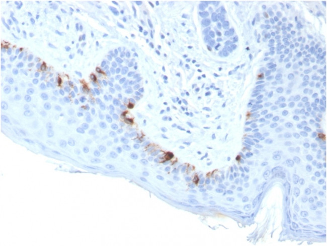 Tyrosinase-Related Protein-1 (TYRP-1) (Melanoma Marker) Antibody in Immunohistochemistry (Paraffin) (IHC (P))