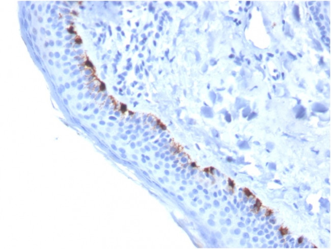 Tyrosinase-Related Protein-1 (TYRP-1) Antibody in Immunohistochemistry (Paraffin) (IHC (P))