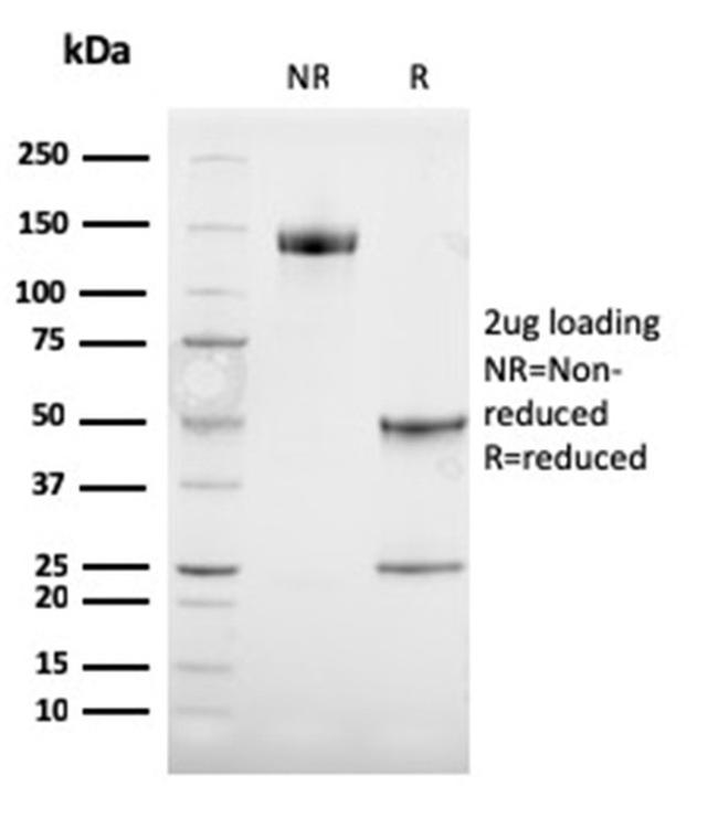 Tyrosinase-Related Protein-1 (TYRP-1) Antibody in SDS-PAGE (SDS-PAGE)