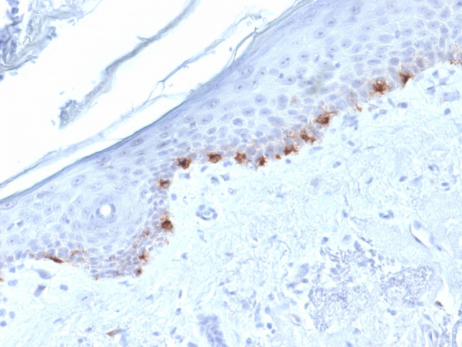 Tyrosinase-Related Protein-1 (TYRP-1) (Melanoma Marker) Antibody in Immunohistochemistry (Paraffin) (IHC (P))