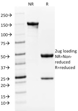 Tyrosinase-Related Protein-1 (TYRP-1) (Melanoma Marker) Antibody in SDS-PAGE (SDS-PAGE)