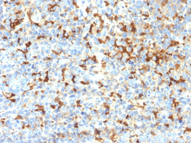 Tyrosinase-Related Protein-1 (TYRP-1) (Melanoma Marker) Antibody in Immunohistochemistry (Paraffin) (IHC (P))