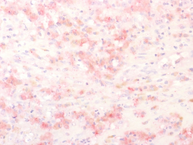 Tyrosinase-Related Protein-1 (TYRP-1) (Melanoma Marker) Antibody in Immunohistochemistry (Paraffin) (IHC (P))