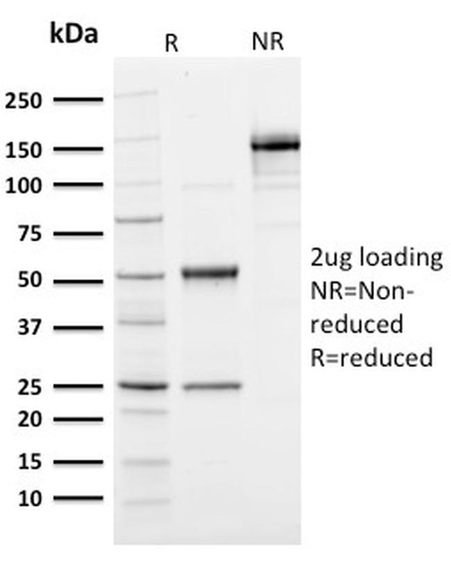 Ubiquitin Antibody in SDS-PAGE (SDS-PAGE)