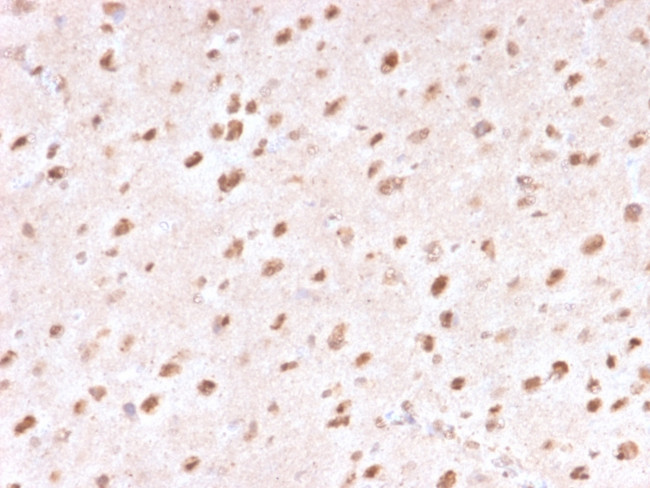 Ubiquitin Antibody in Immunohistochemistry (Paraffin) (IHC (P))