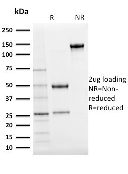 Ubiquitin (Autophagy Marker) Antibody in SDS-PAGE (SDS-PAGE)