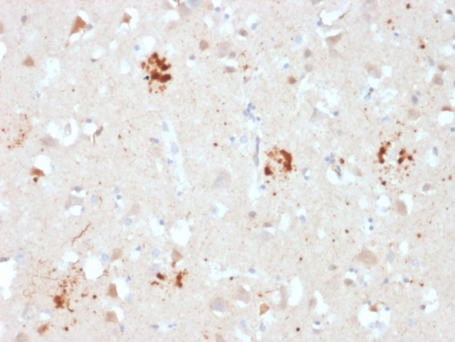 Ubiquitin (Autophagy Marker) Antibody in Immunohistochemistry (Paraffin) (IHC (P))