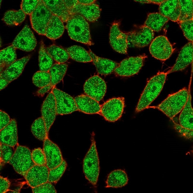 UBE2B Antibody in Immunocytochemistry (ICC/IF)